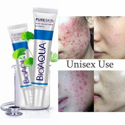 Bioaqua Crema Removedora De Acne